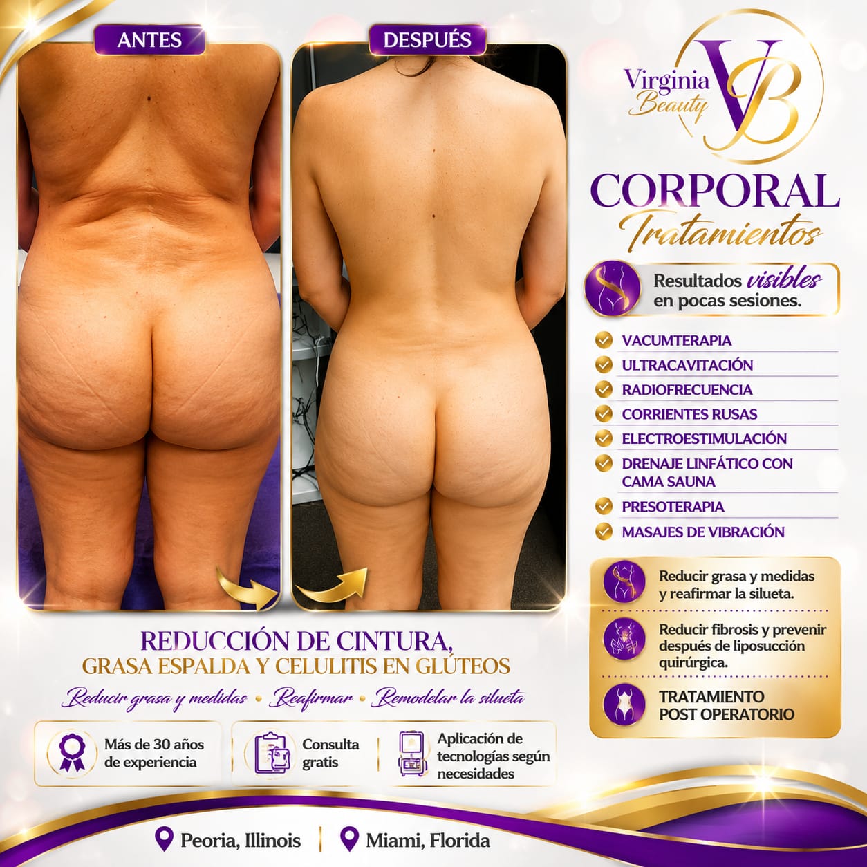 Reducción de cintura, grasa de espalda y celulitis