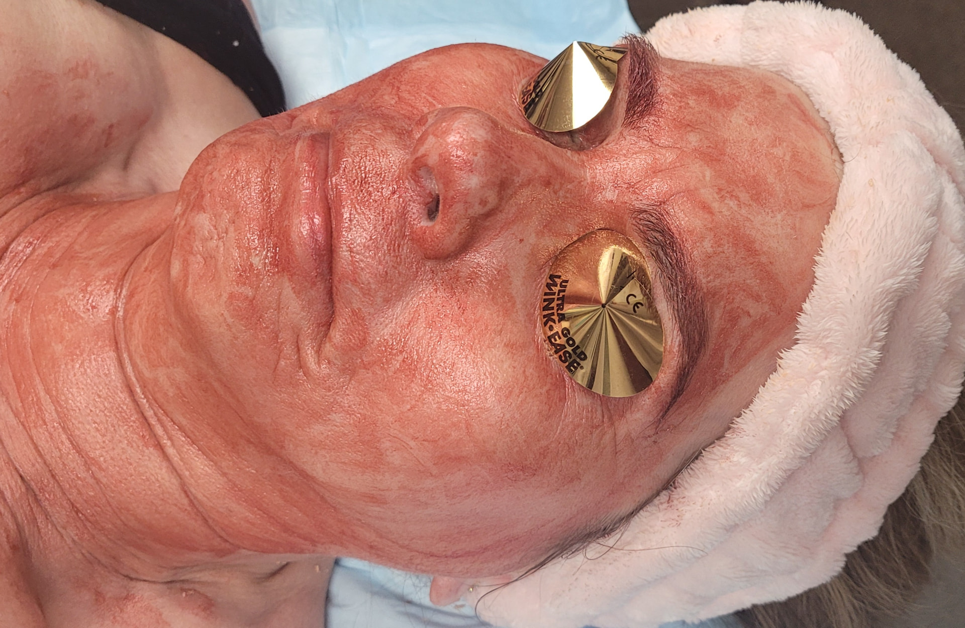 Cuidado Facial