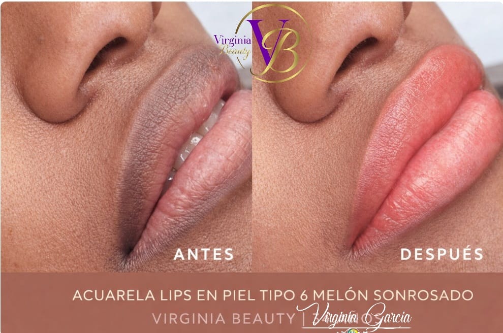 Acuarela Lips en piel tipo 6 melón sonrosado – antes y después